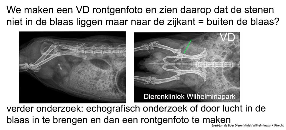 Er zijn twee stenen te zien die niet in het midden van de blaas liggen op de VD foto